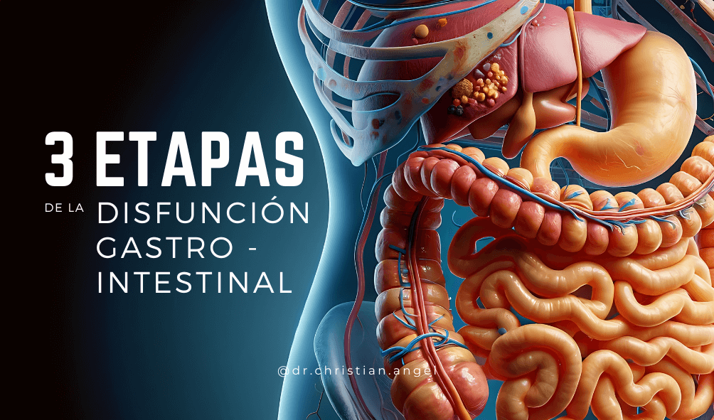 3 etapas de la DISFUNCIÓN GASTROINTESTINAL
